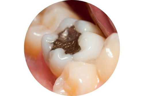 amalgam-circle.jpg