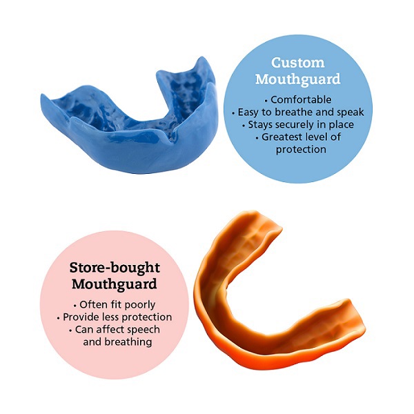 Mouthguards