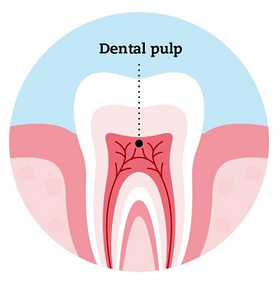 Dental Pulp