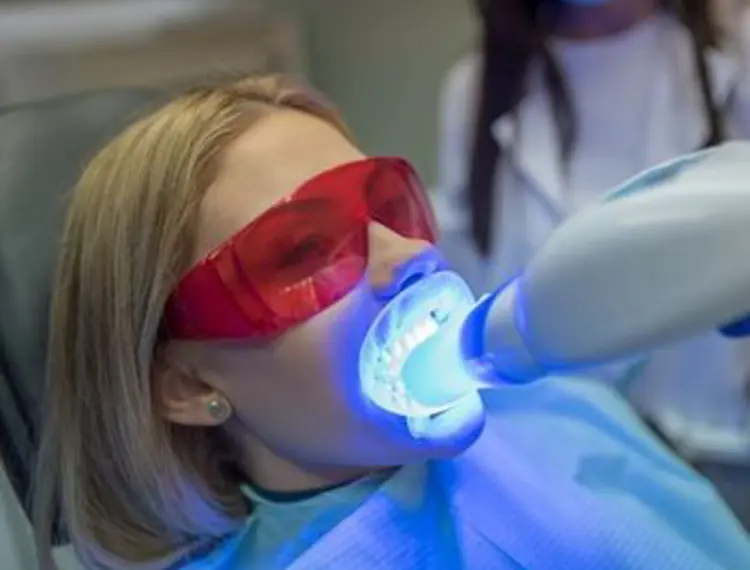 Teeth Whitening