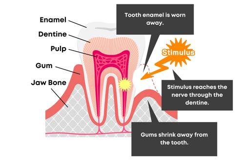 sensitive-teeth-redone-1.jpg