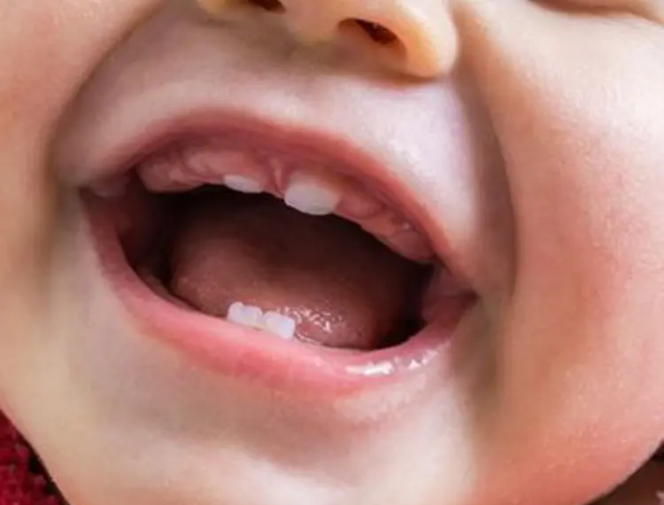 Lip frenum