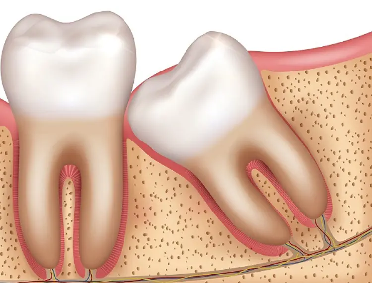 Gum pain behind last store molar no wisdom teeth